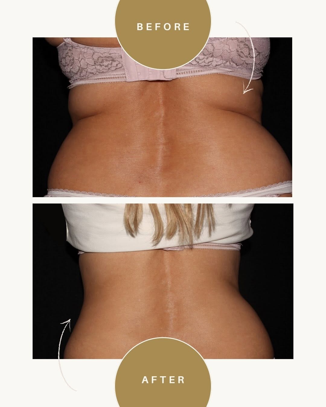 Post 4 by Medical Rejuvenation Centre on Instagram (carousel)