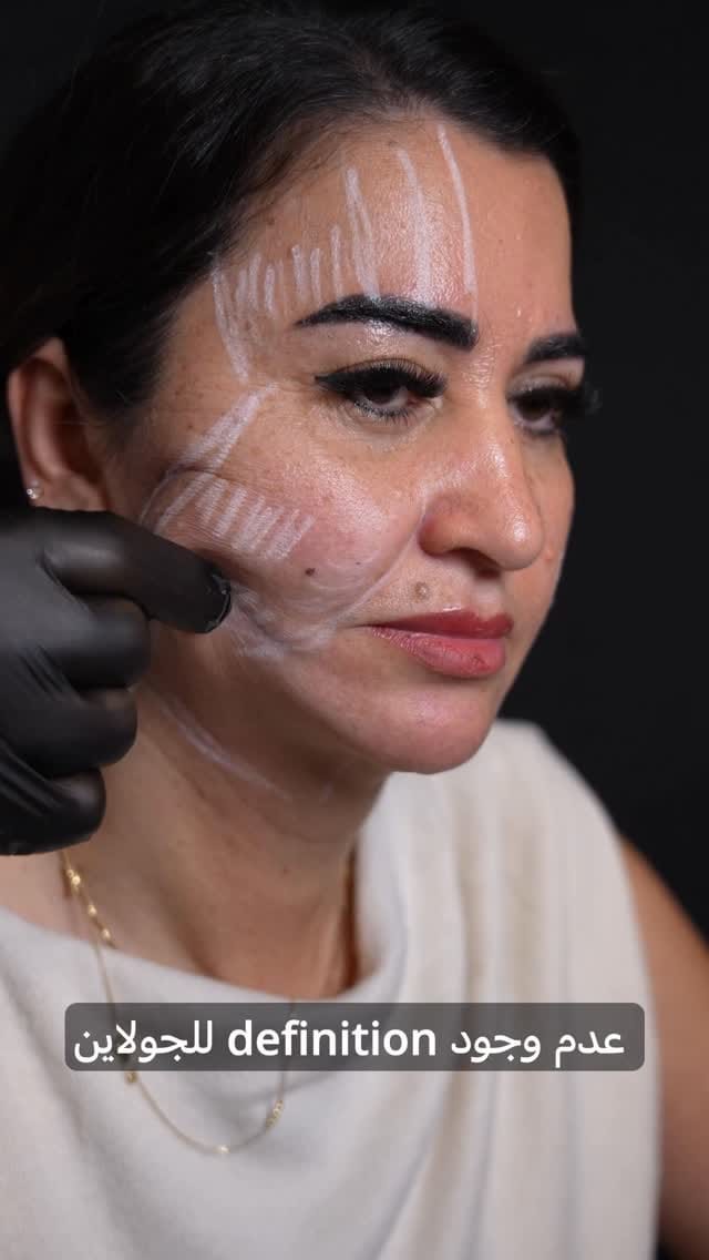 Post 3 by Basil hassouneh on Instagram (video)