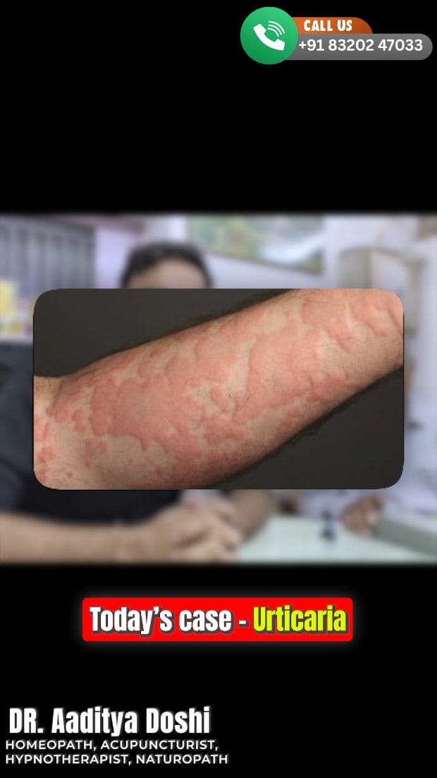 Post 10 by DrAaditya Doshi on Instagram (video)