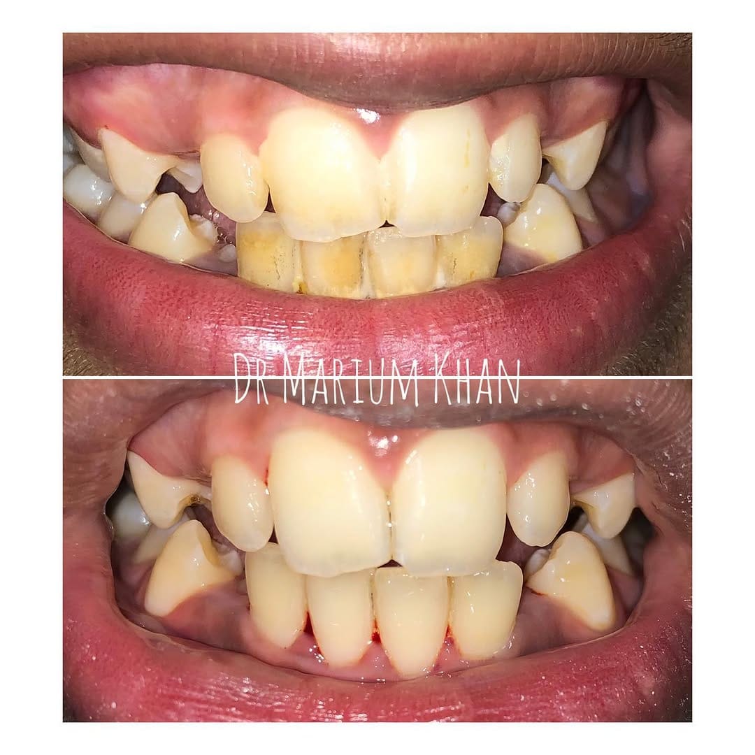 Post 4 by Dr. Marium Khan on Instagram (image)