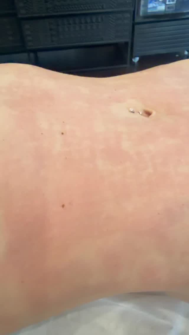Post 1 by Ambea Clinic on Instagram (video)