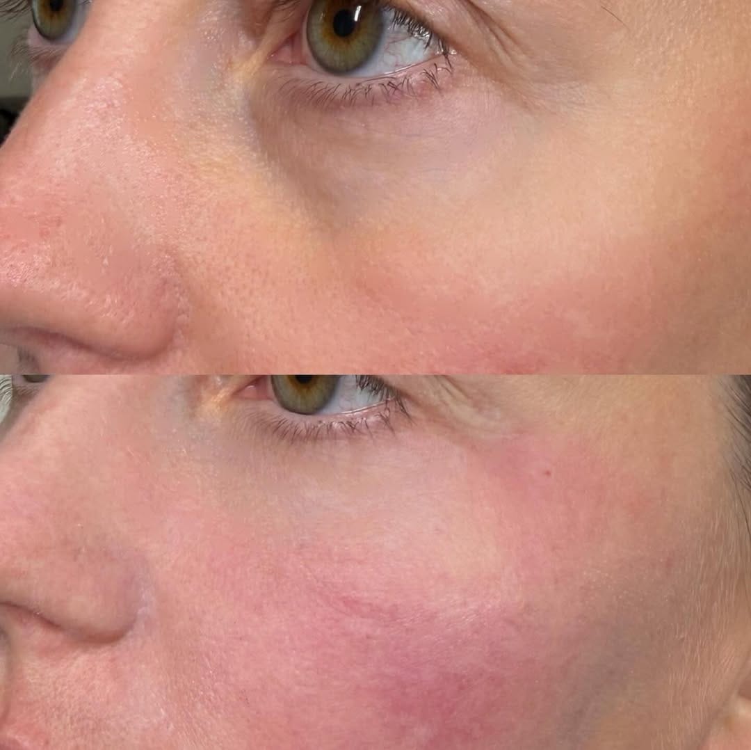 Post 7 by Ambea Clinic on Instagram (image)