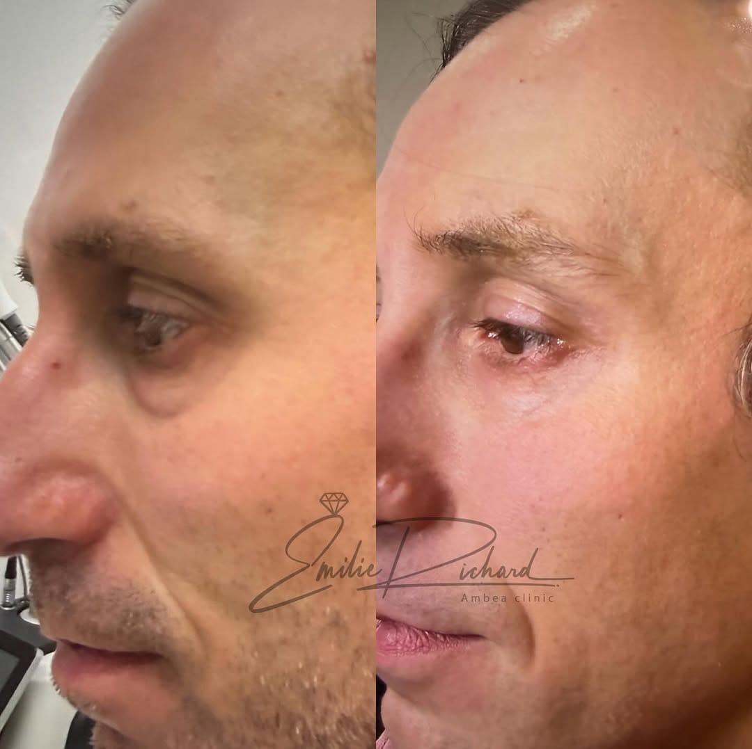 Post 4 by Ambea Clinic on Instagram (carousel)