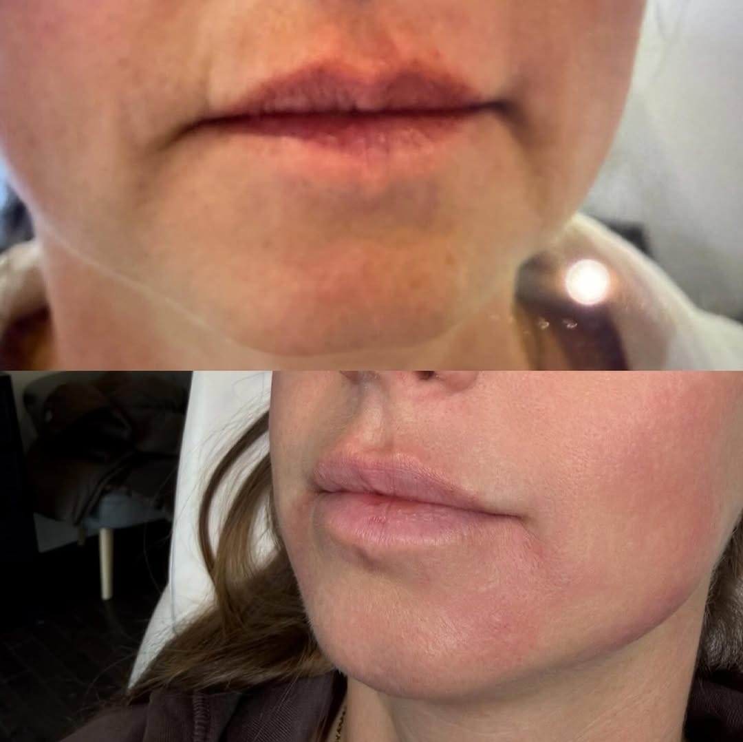 Post 9 by Ambea Clinic on Instagram (image)