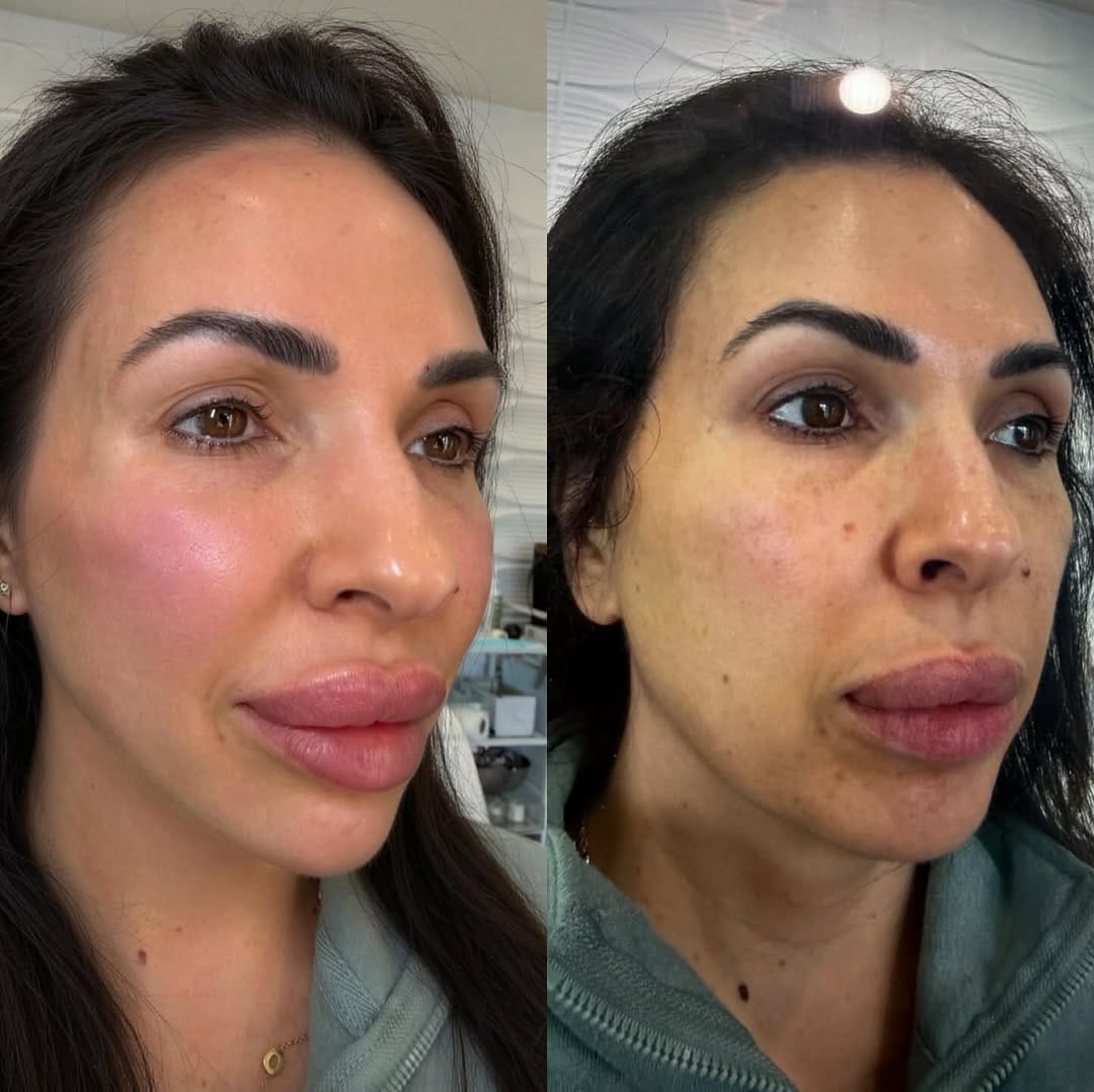 Post 2 by Ambea Clinic on Instagram (image)