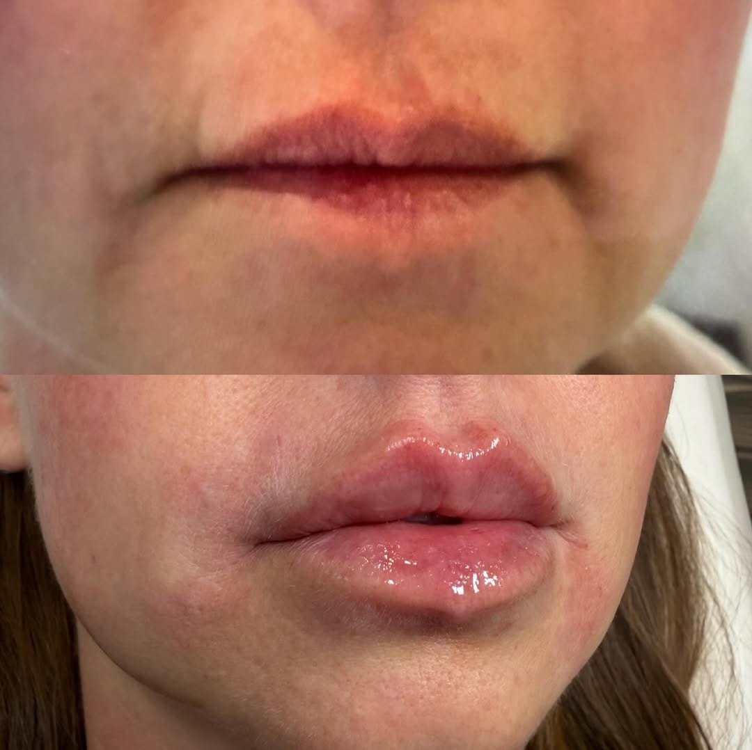 Post 10 by Ambea Clinic on Instagram (image)