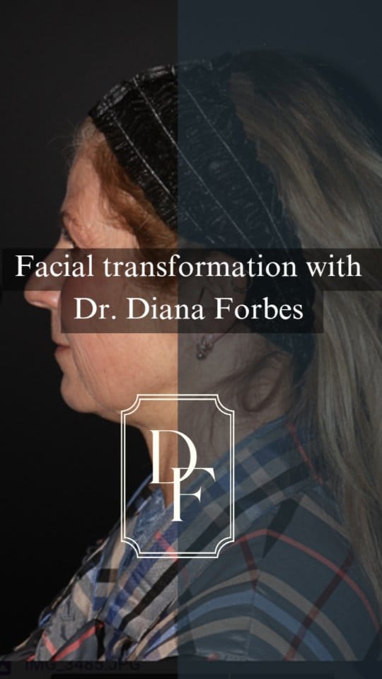 Post 10 by Dr. Diana Forbes on Instagram (video)