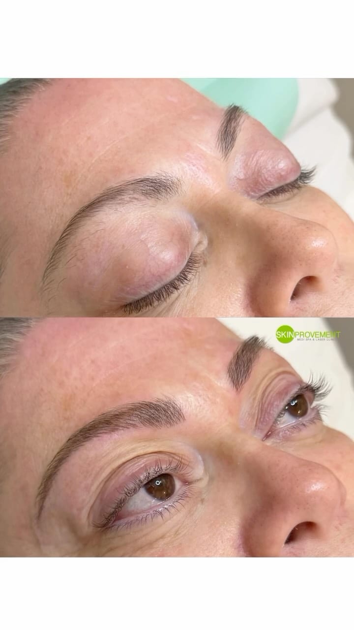 Post 7 by Skinprovement Medi Spa & Laser Clinic on Instagram (video)