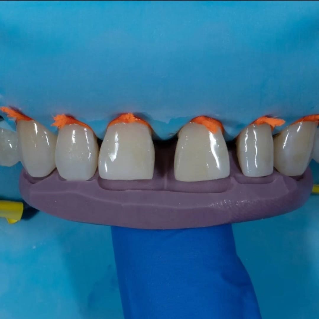 Post 10 by Dr. Sunny Virdi on Instagram (carousel)