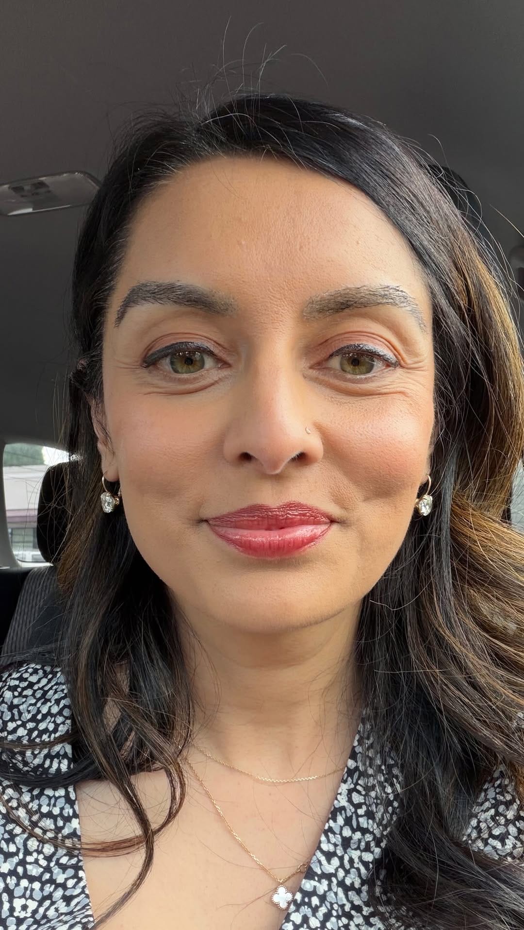 Post 1 by Priya Mistry, DDS, D. ABDSM on Instagram (video)