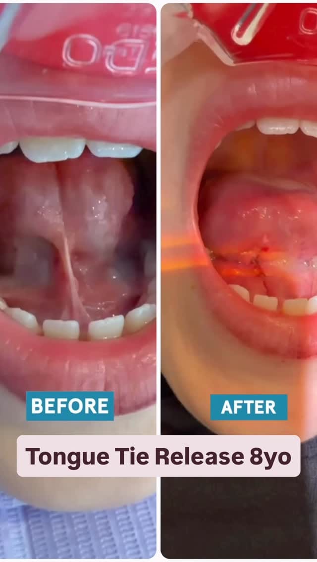 Post 4 by SmileSquad Kids Dental on Instagram (video)