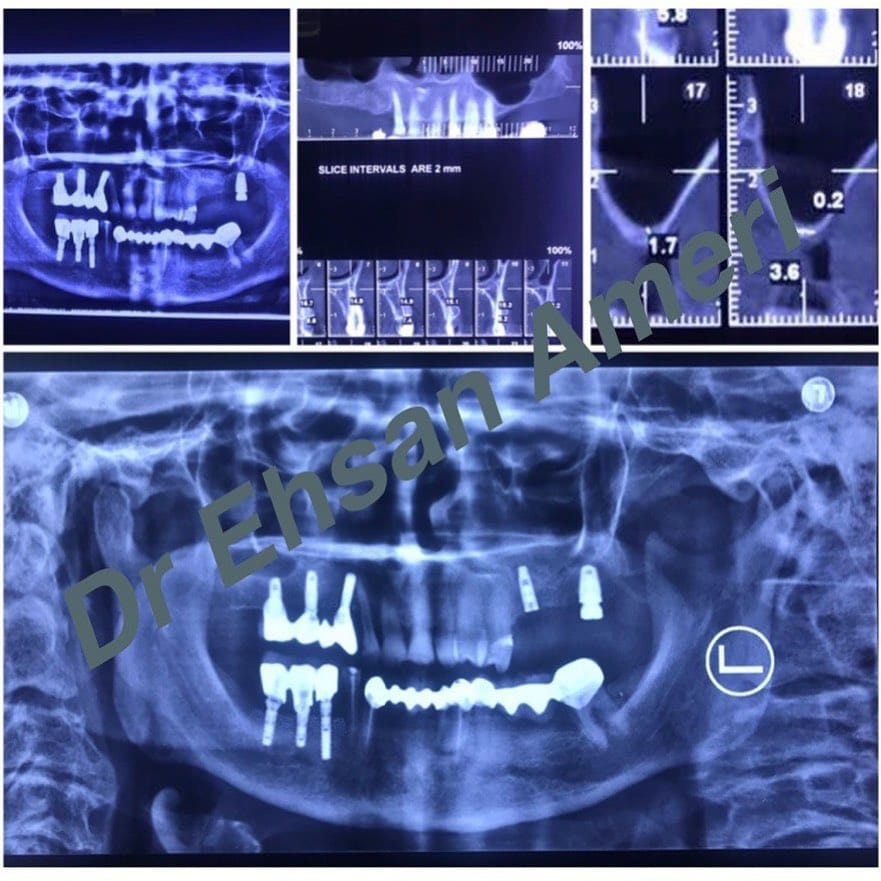 Post 8 by Dr Ariya(Ehsan)Ameri on Instagram (image)