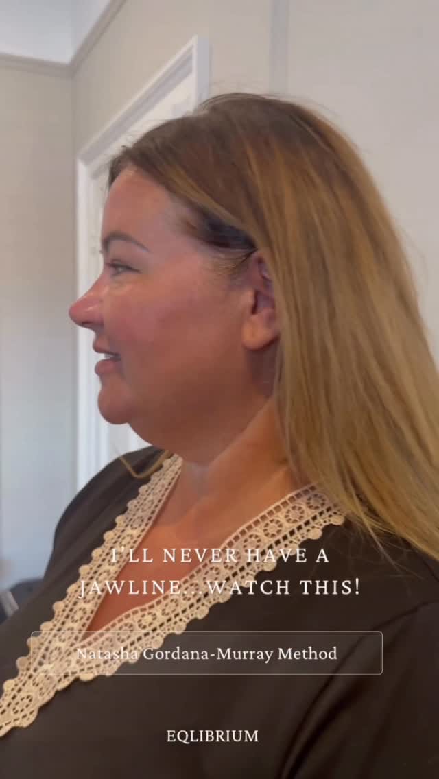 Post 4 by EQlibrium Clinic PDO thread & aesthetics on Instagram (video)