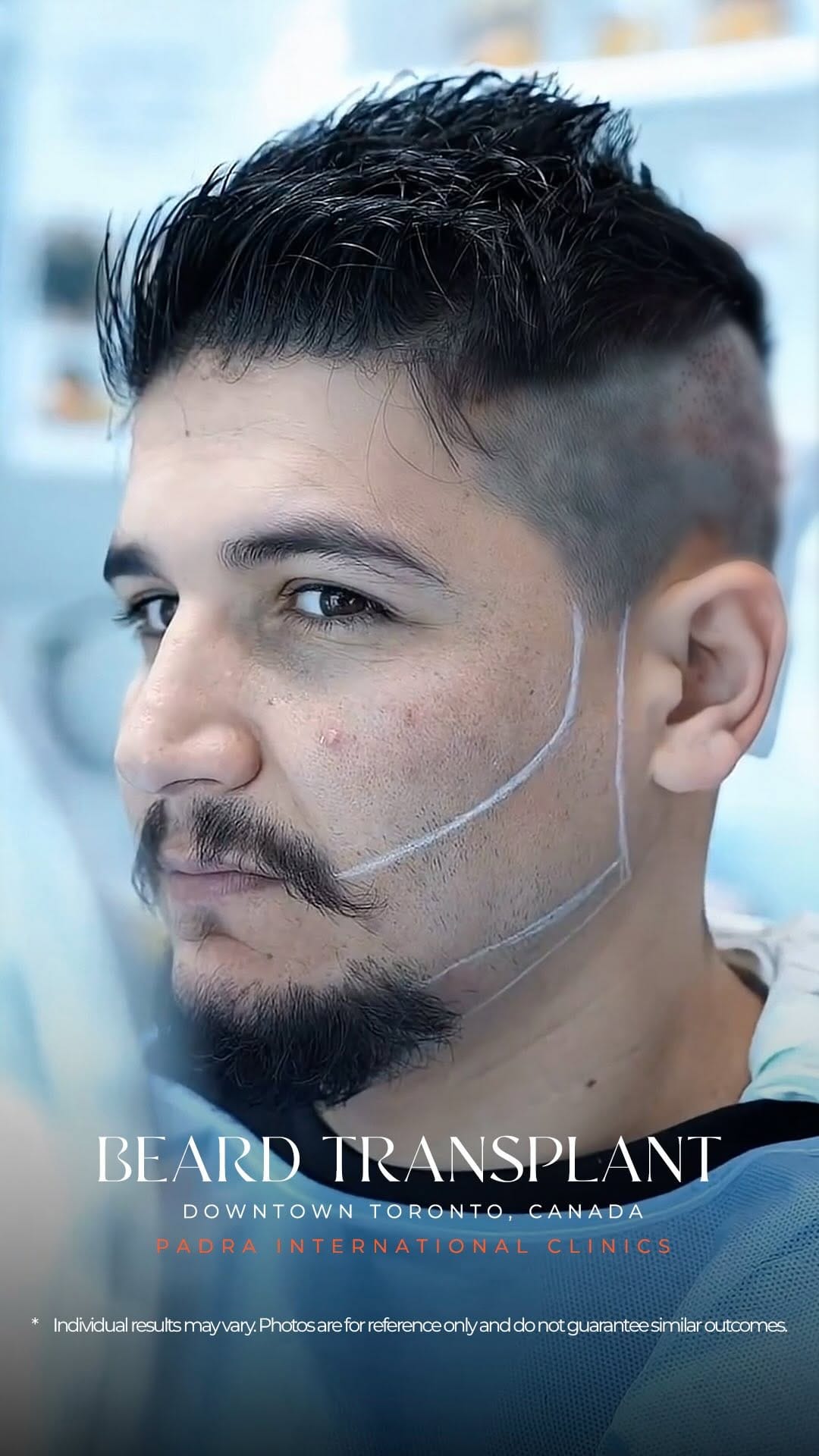 Post 3 by Padra Clinic Canada on Instagram (video)