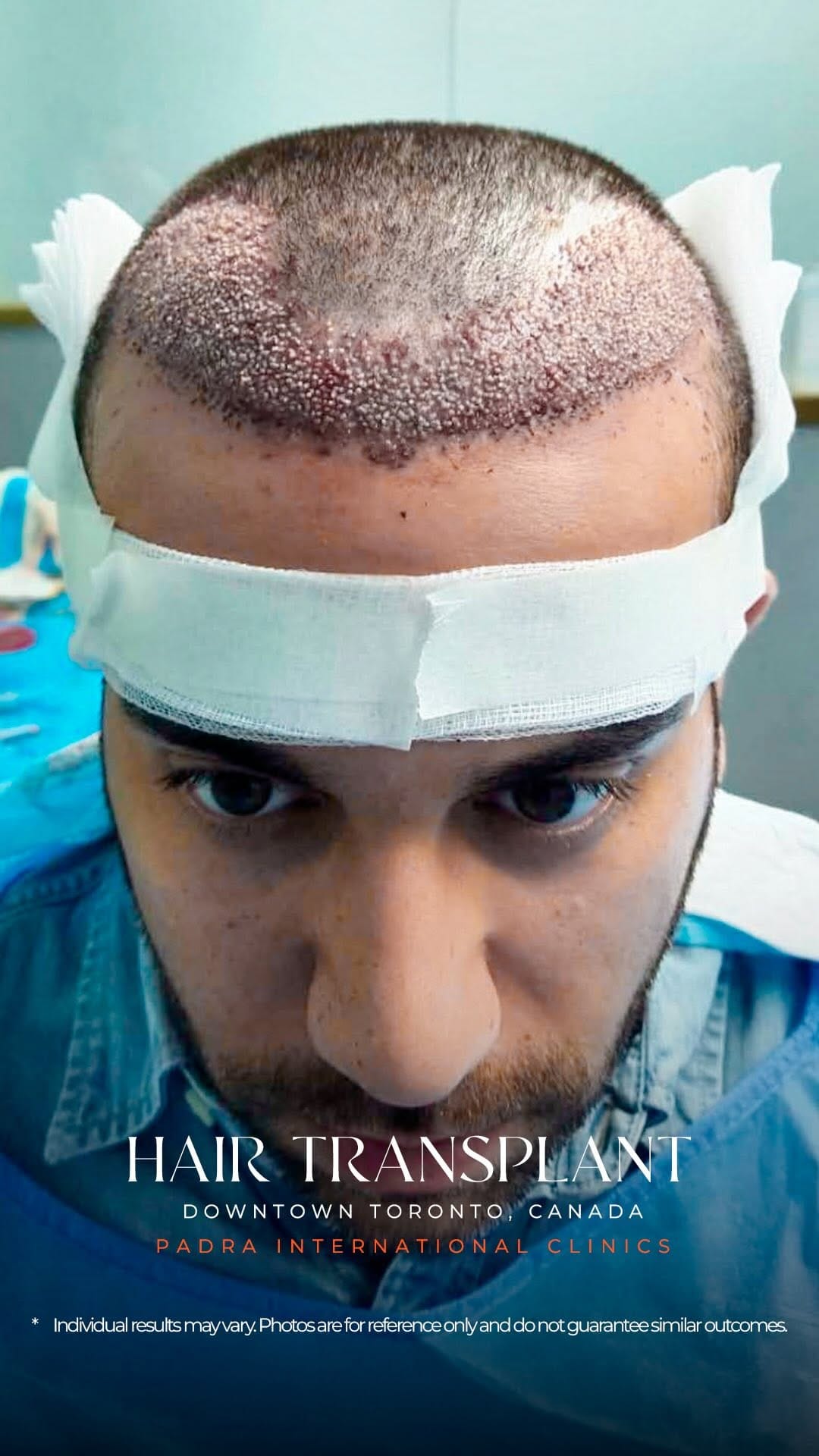 Post 5 by Padra Clinic Canada on Instagram (video)