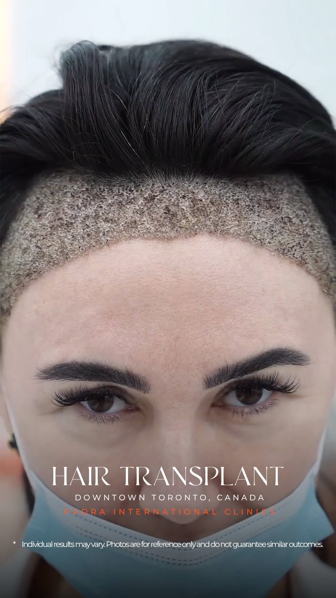 Post 1 by Padra Clinic Canada on Instagram (video)