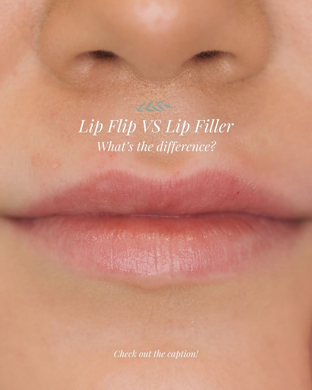 Post 7 by Organic Glow Medical Aesthetics on Instagram (image)