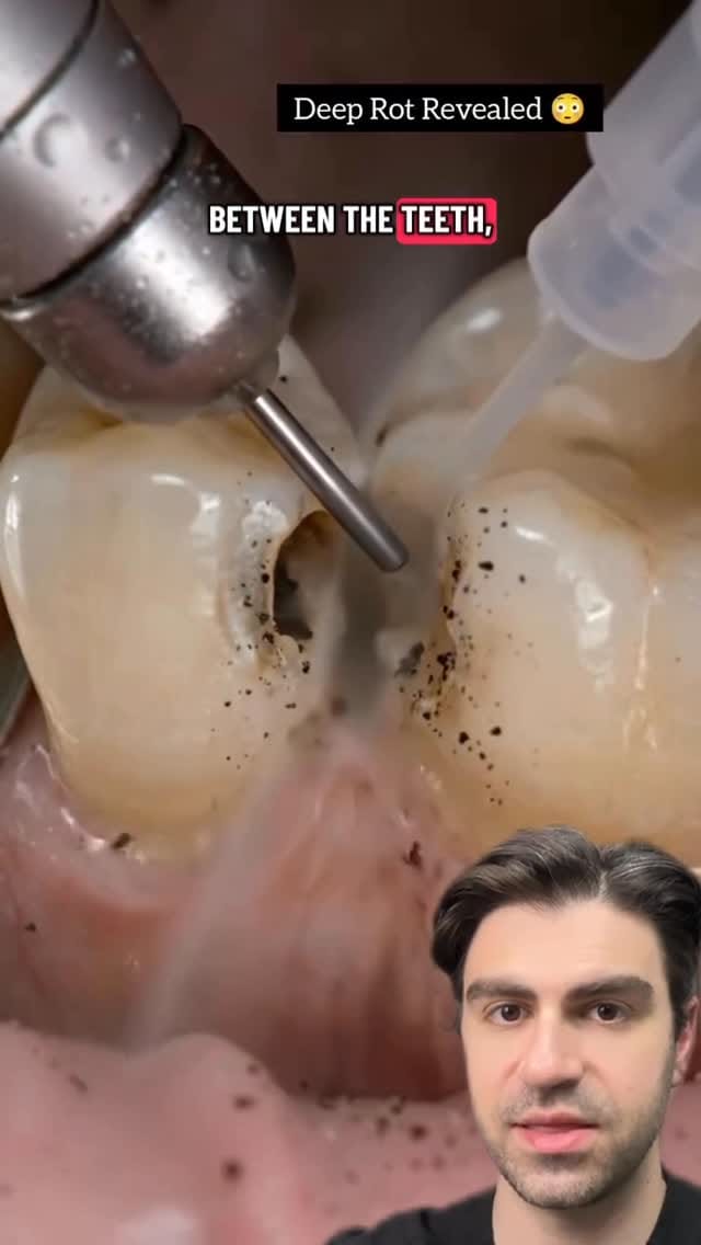 Post 4 by Dr. Kadish - Family Dentist on Instagram (video)