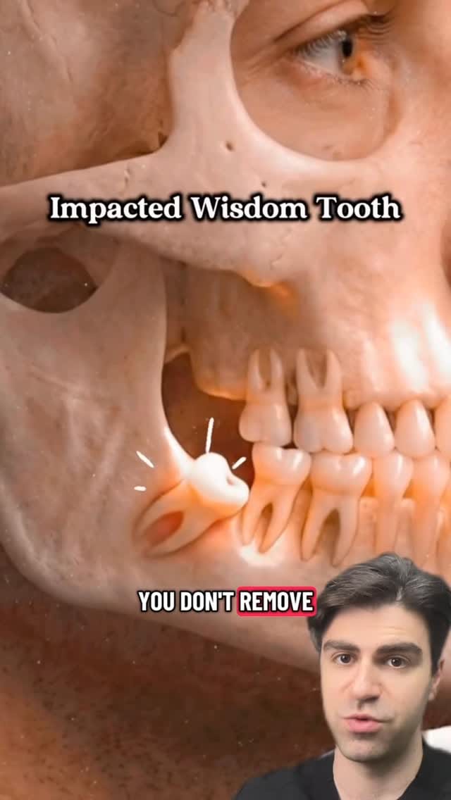 Post 9 by Dr. Kadish - Family Dentist on Instagram (video)