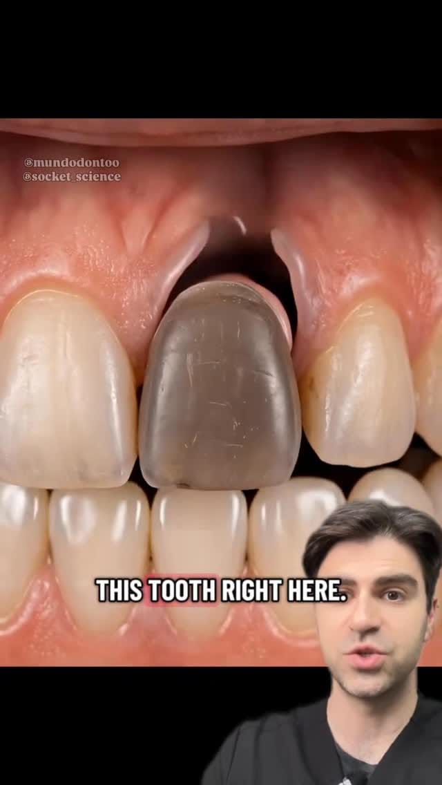 Post 7 by Dr. Kadish - Family Dentist on Instagram (video)