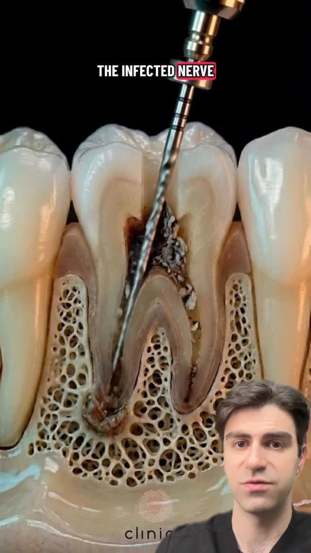 Post 5 by Dr. Kadish - Family Dentist on Instagram (video)