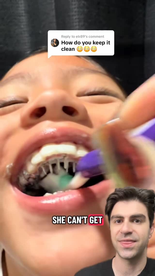 Post 2 by Dr. Kadish - Family Dentist on Instagram (video)