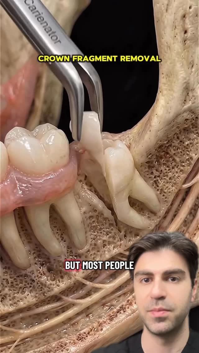 Post 6 by Dr. Kadish - Family Dentist on Instagram (video)