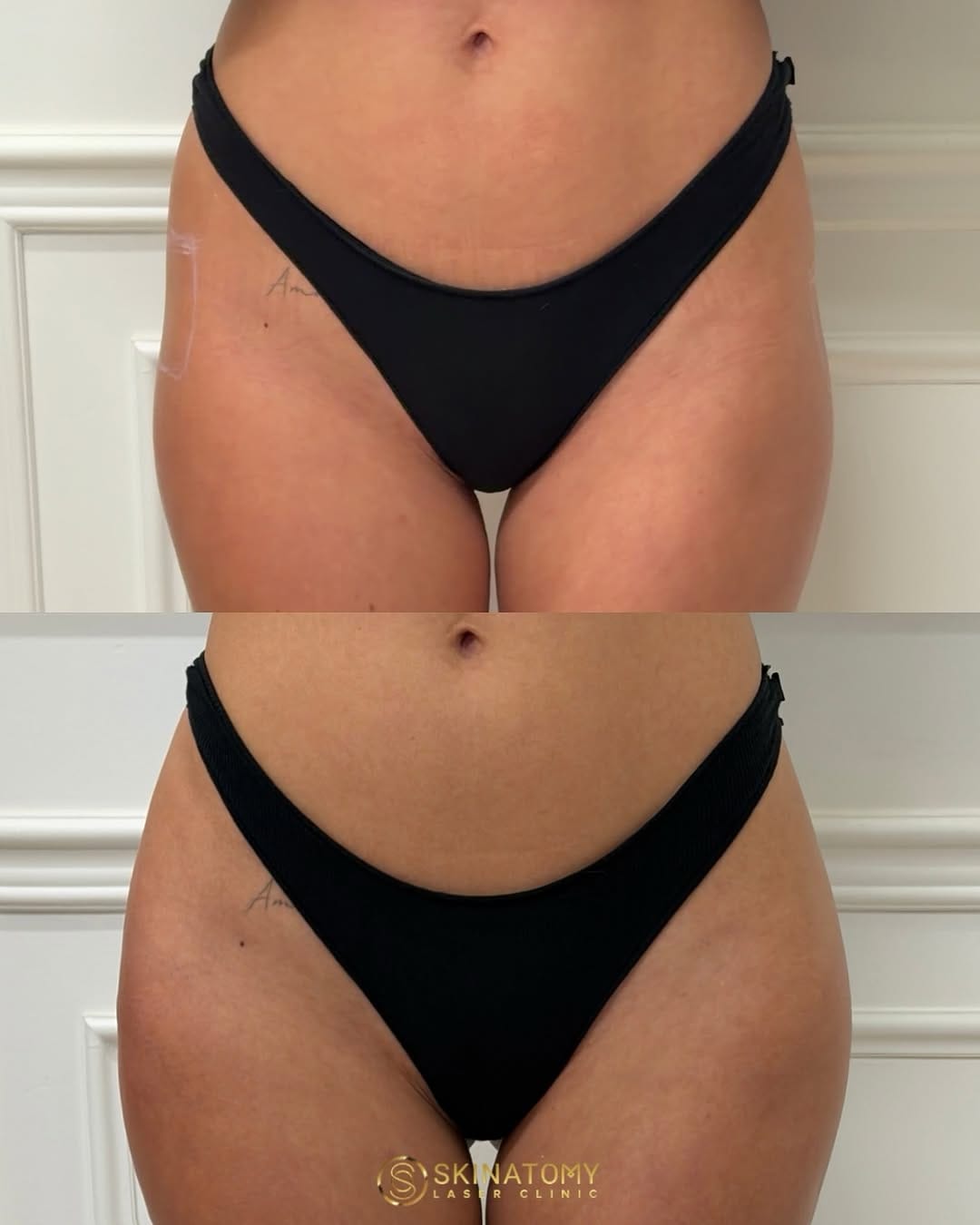 Post 9 by Skinatomy Laser Clinic on Instagram (image)