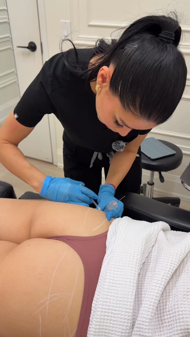 Post 6 by Skinatomy Laser Clinic on Instagram (video)