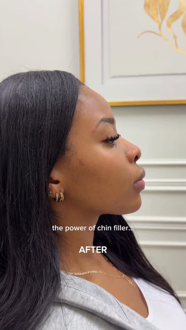 Post 5 by Skinatomy Laser Clinic on Instagram (video)