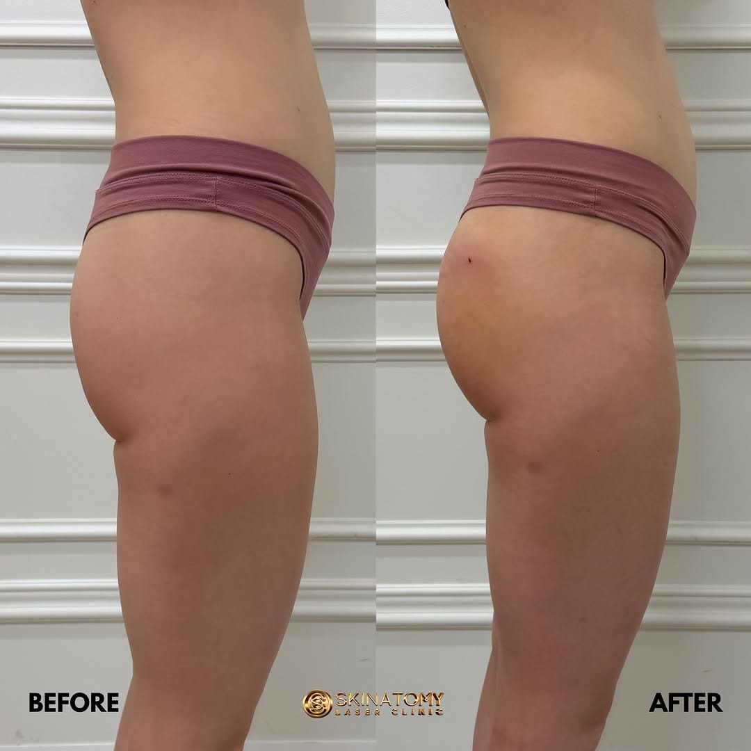 Post 7 by Skinatomy Laser Clinic on Instagram (image)