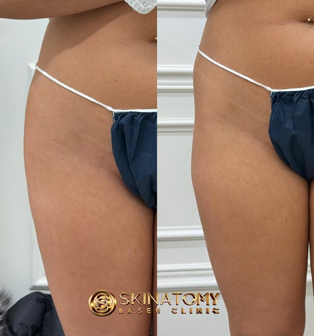 Post 8 by Skinatomy Laser Clinic on Instagram (image)