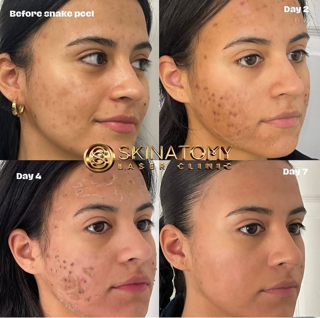 Post 10 by Skinatomy Laser Clinic on Instagram (image)