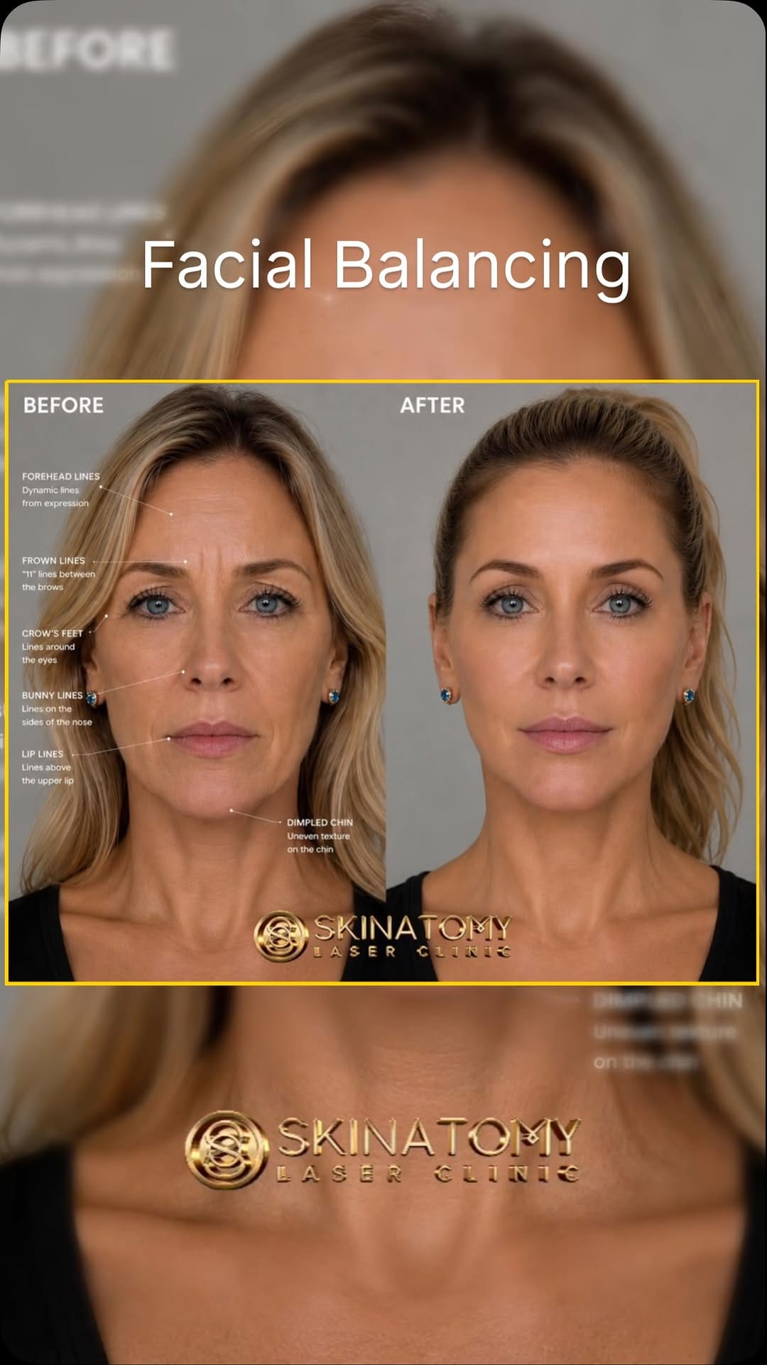 Post 3 by Skinatomy Laser Clinic on Instagram (video)