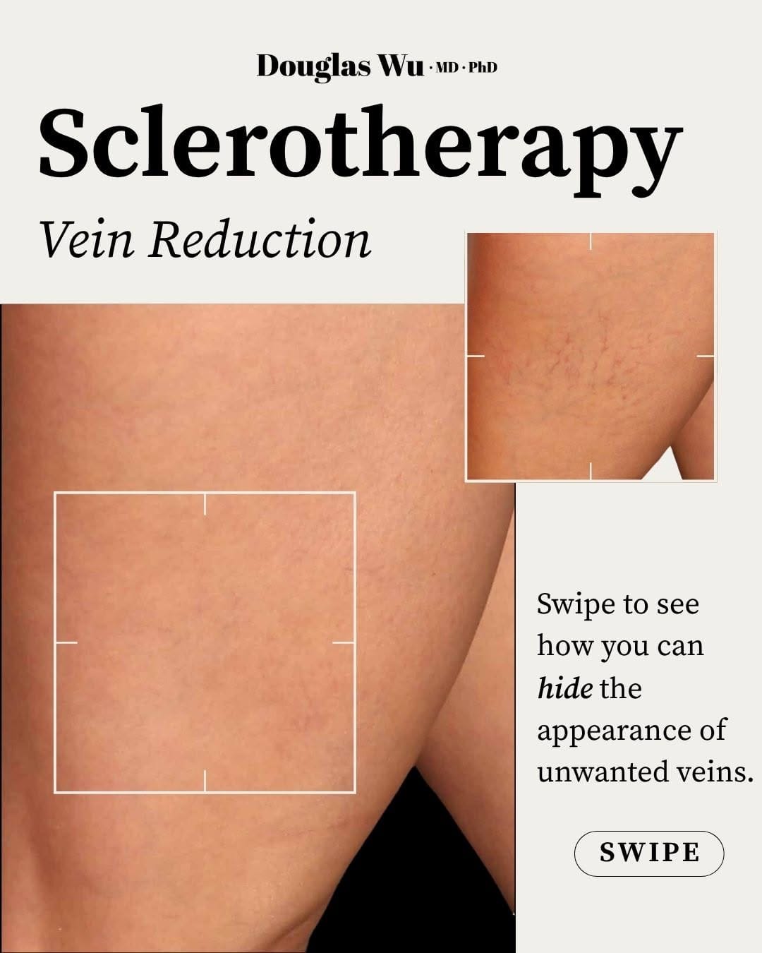 Post 3 by Douglas Wu, MD, PhD | Cosmetic Dermatologist on Instagram (carousel)
