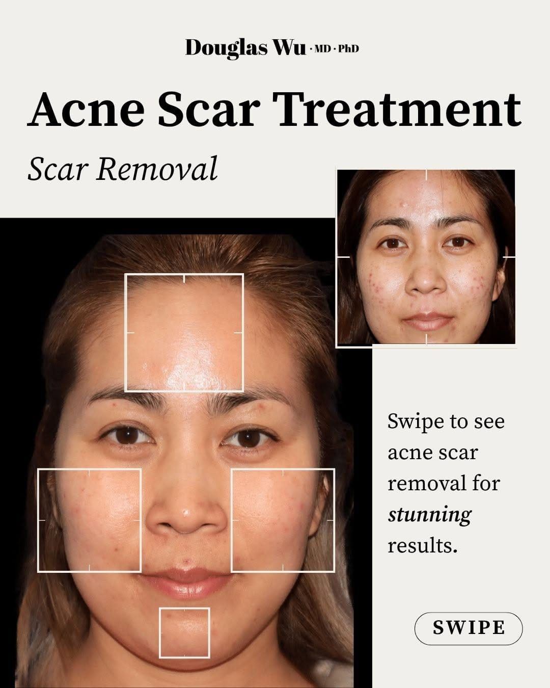 Post 5 by Douglas Wu, MD, PhD | Cosmetic Dermatologist on Instagram (carousel)
