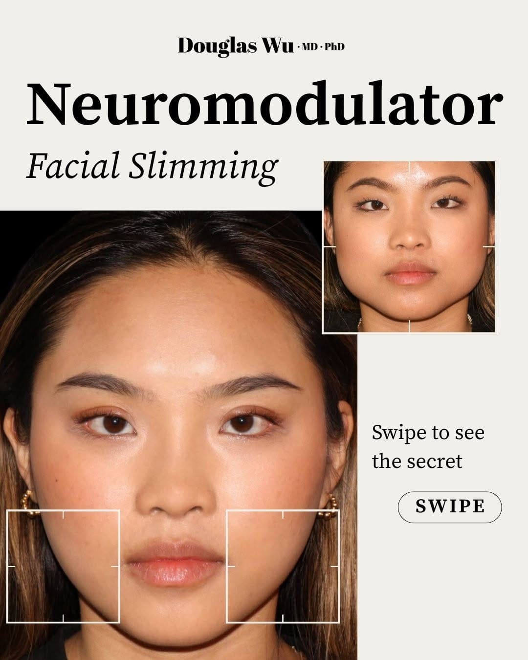Post 7 by Douglas Wu, MD, PhD | Cosmetic Dermatologist on Instagram (carousel)