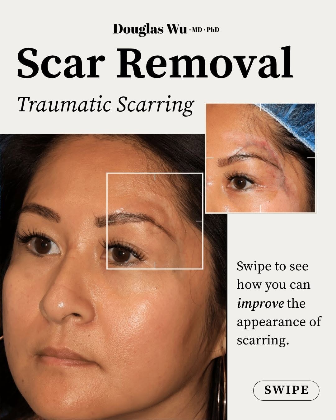 Post 1 by Douglas Wu, MD, PhD | Cosmetic Dermatologist on Instagram (carousel)