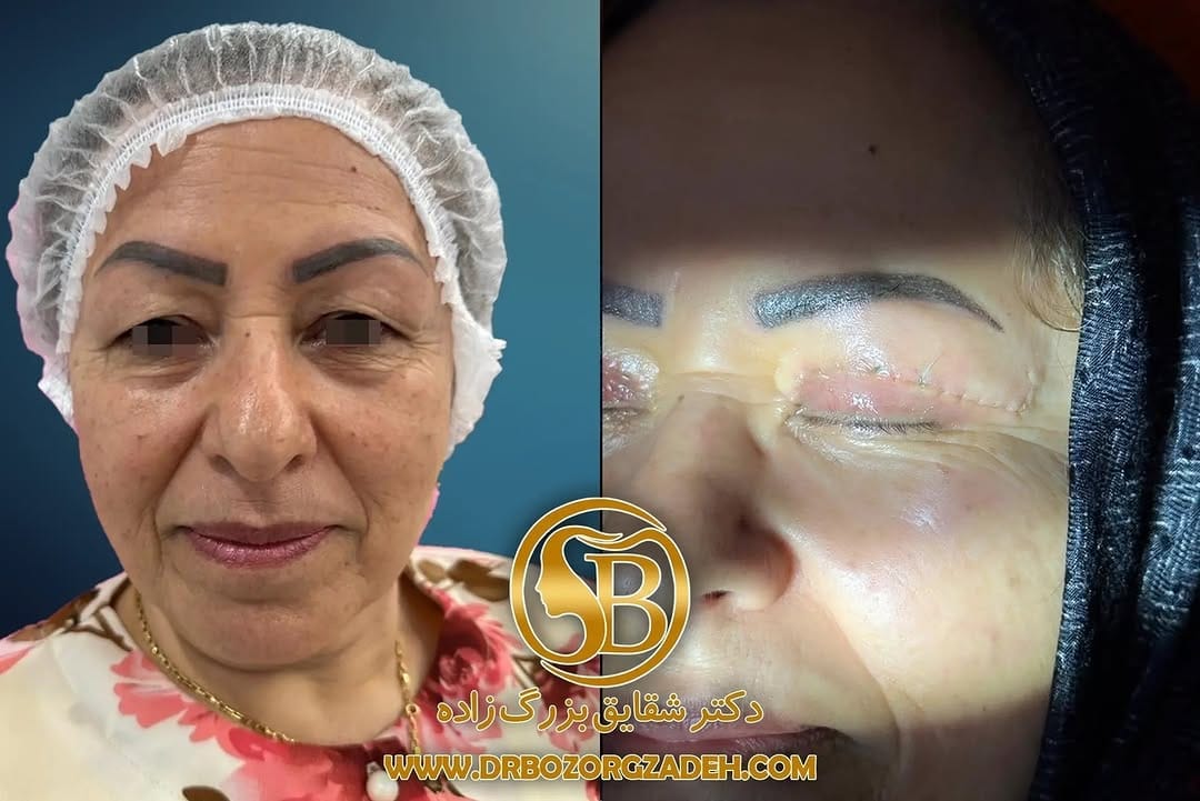 Post 6 by dr.BozorgZadeh ,Oral&Maxillofacial surgeon on Instagram (image)