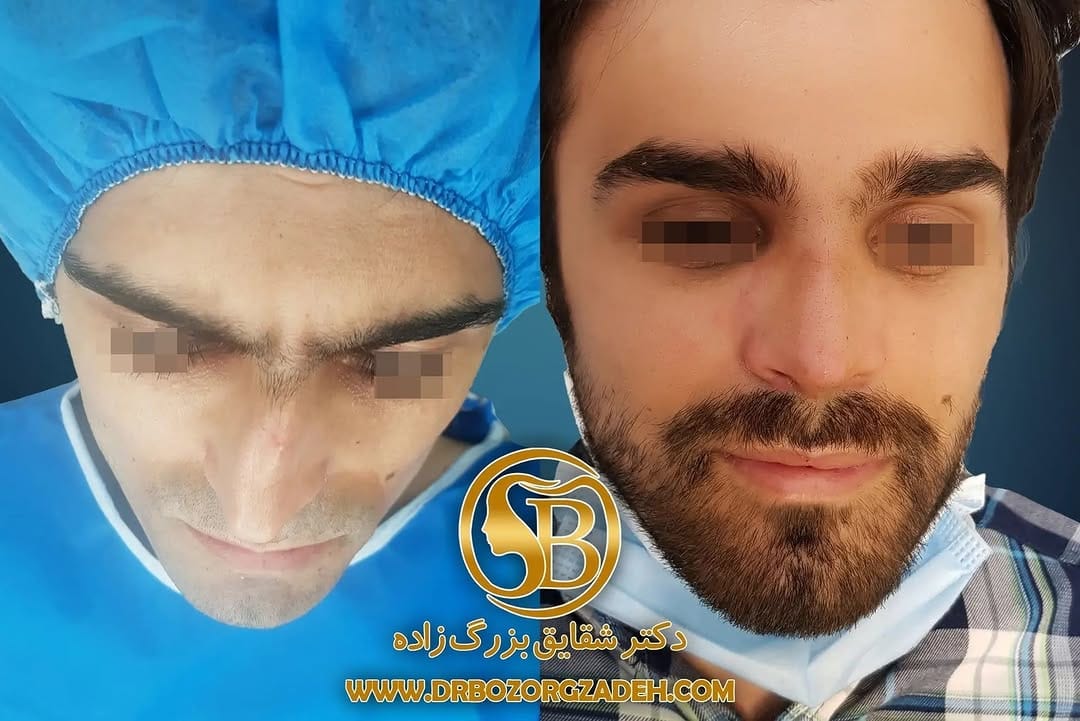 Post 7 by dr.BozorgZadeh ,Oral&Maxillofacial surgeon on Instagram (image)