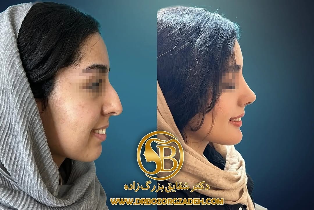 Post 9 by dr.BozorgZadeh ,Oral&Maxillofacial surgeon on Instagram (image)