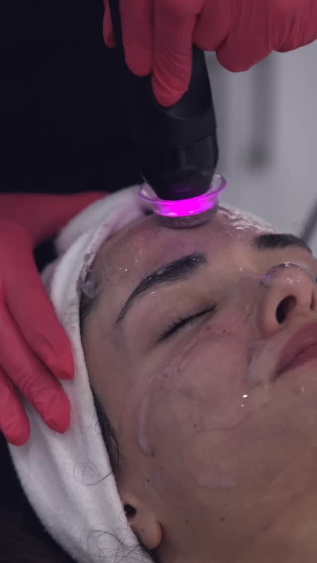 Post 4 by Forest Hill Cosmetic Clinic - Medical Aesthetics on Instagram (video)