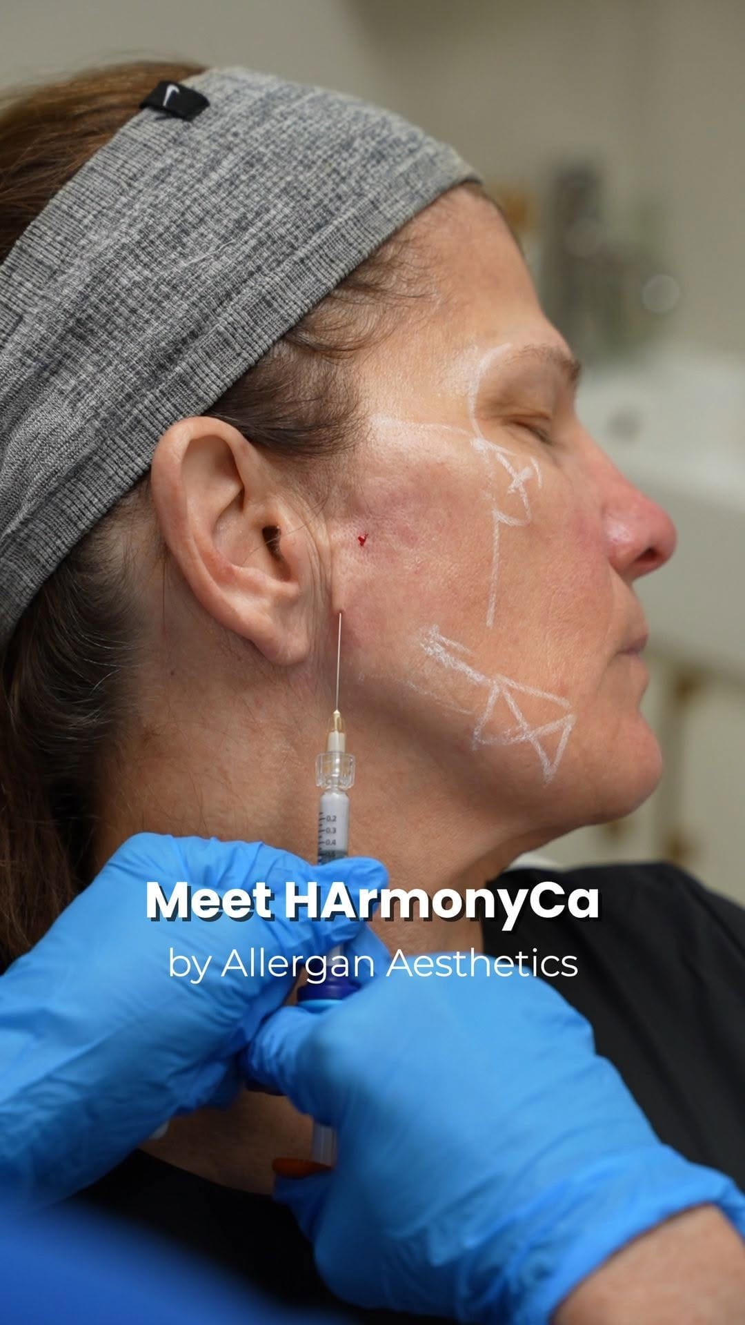 Post 4 by Visage Clinical Beauty on Instagram (video)