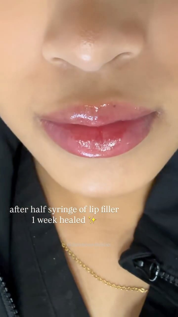 Post 3 by Visage Clinical Beauty on Instagram (video)