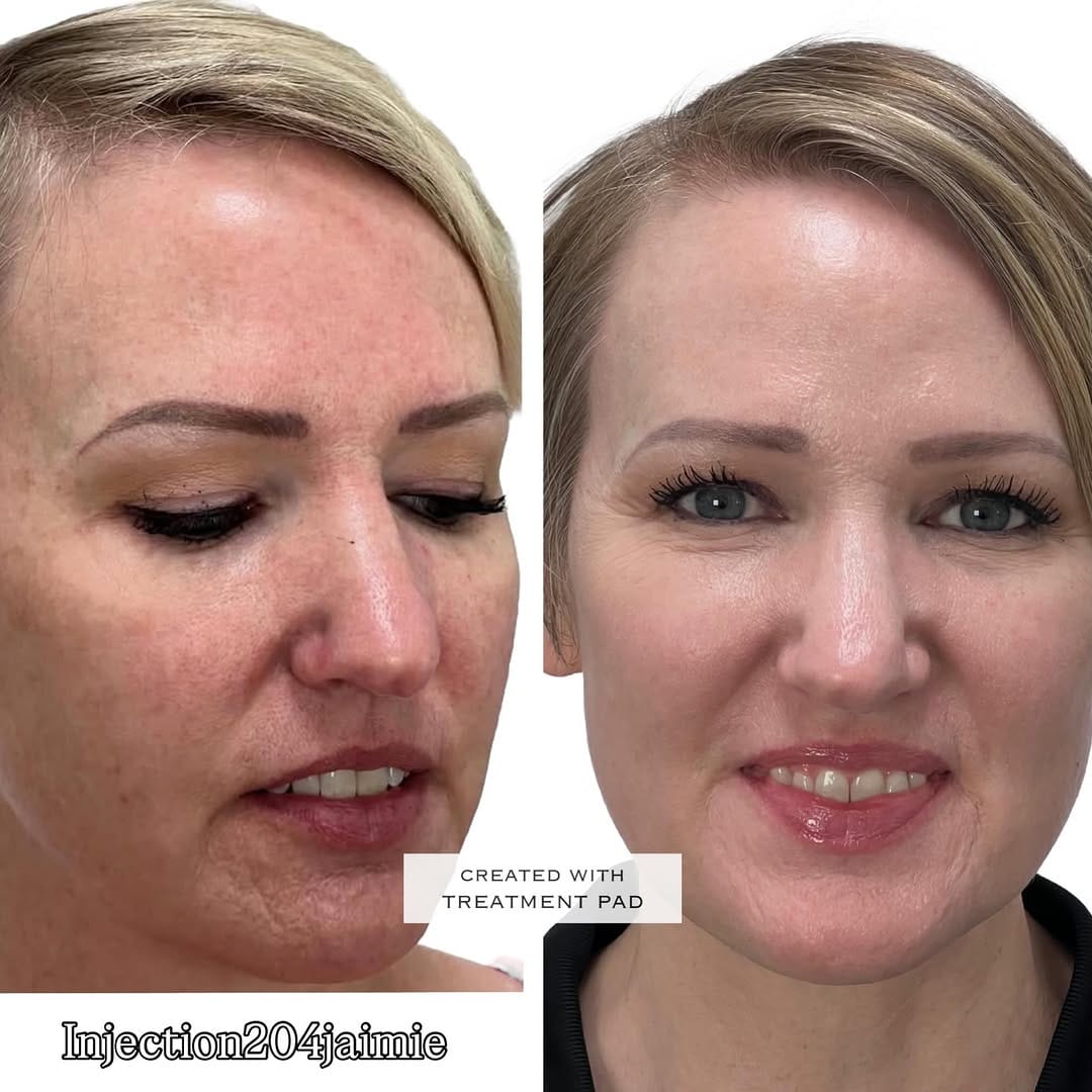 Post 5 by Visage Clinical Beauty on Instagram (image)