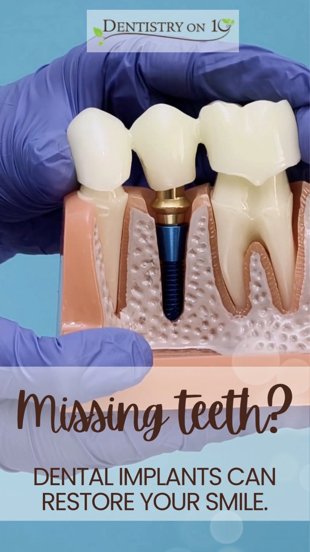 Post 3 by Dr. Rina Raichada, DMD on Instagram (video)