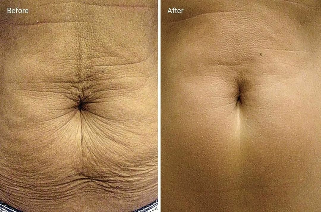 Post 9 by YS Canadian Laser Spa on Instagram (image)