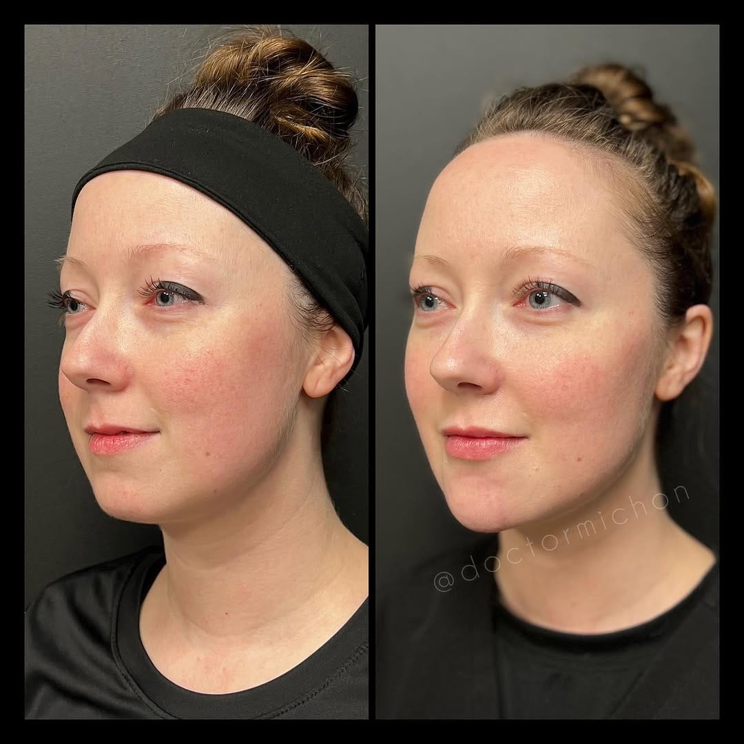 Post 10 by Dr Alain Michon, MD, MSc, PG Dip. Clinical Dermatology on Instagram (carousel)