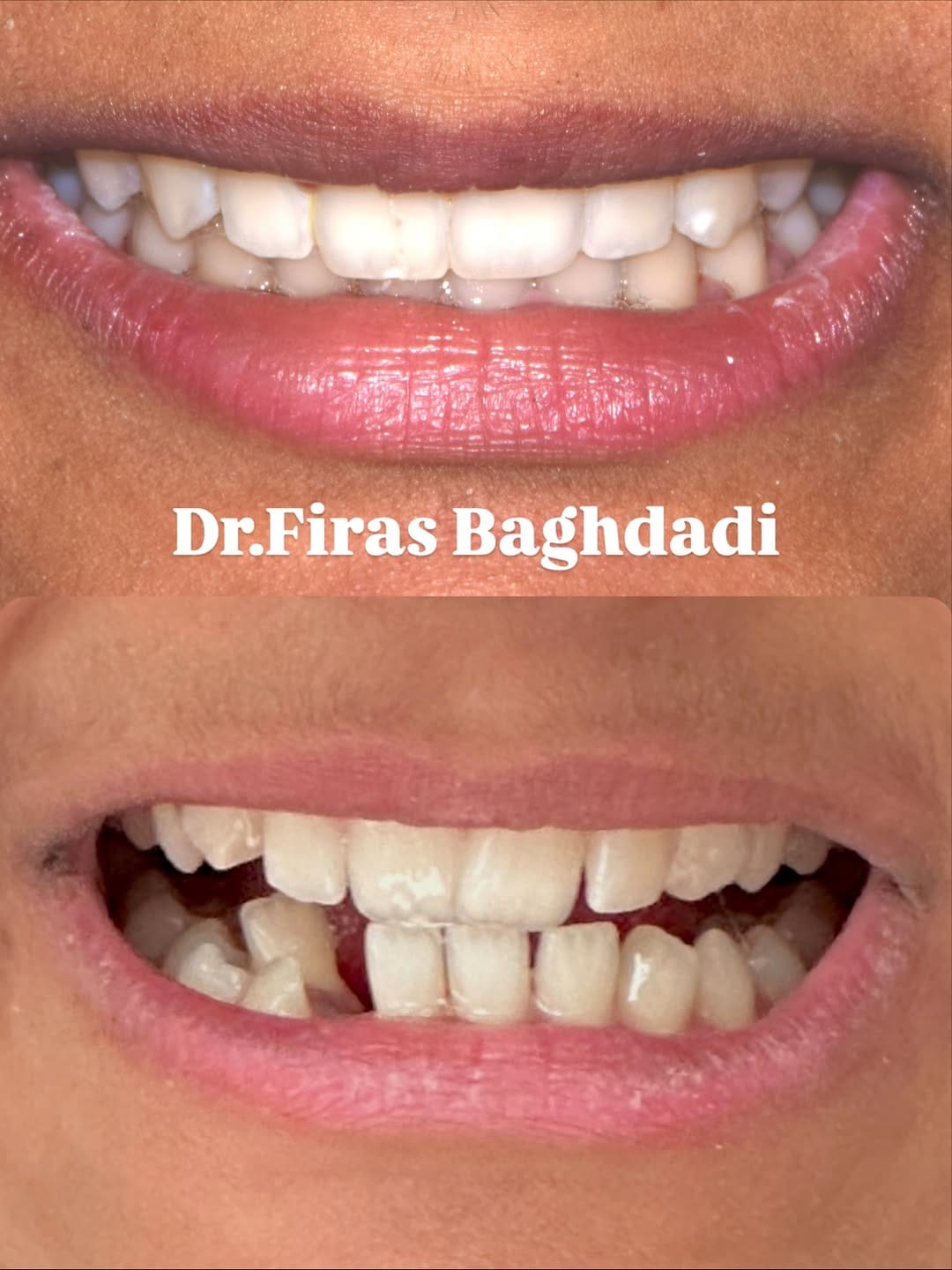 Post 7 by Dr Firas Baghdadi DMD on Instagram (carousel)