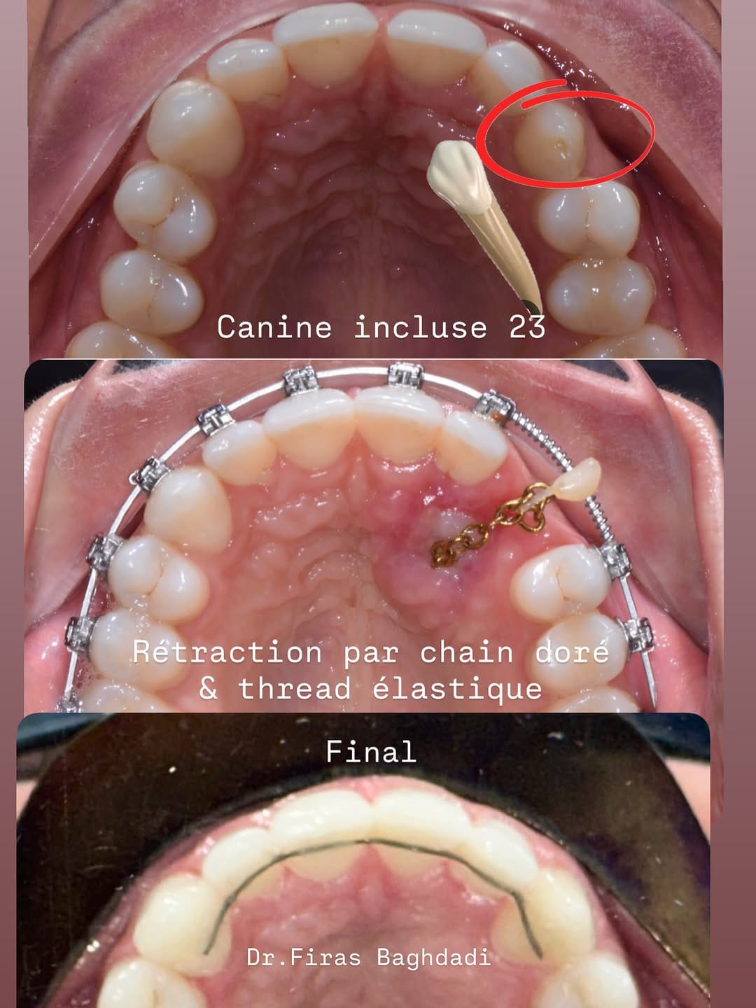 Post 4 by Dr Firas Baghdadi DMD on Instagram (image)